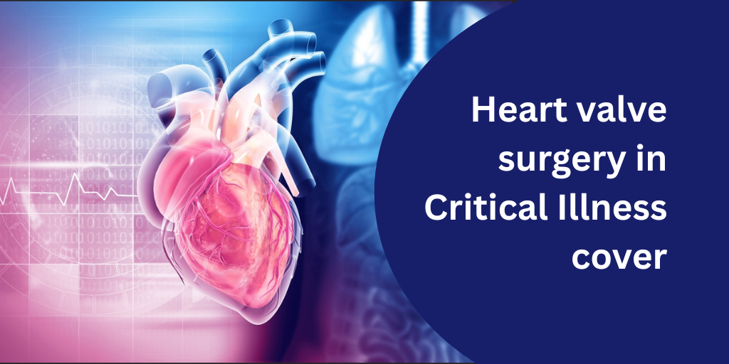 Heart valve surgery in Critical Illness cover