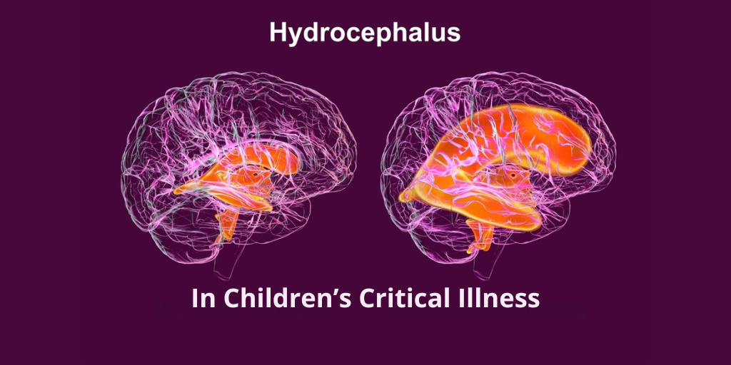 Hydrocephalus in Children’s Critical Illness