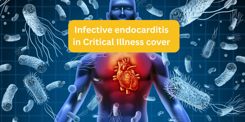 Infective endocarditis in Critical Illness cover