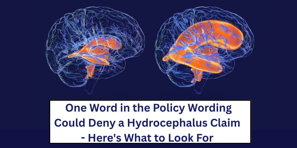 One Word in the Policy Wording Could Deny a Hydrocephalus Claim — Here’s What to Look For