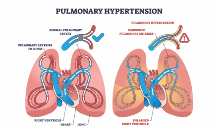Could Your Client’s Pulmonary Hypertension Diagnosis Actually Fall Outside Their CI Cover?