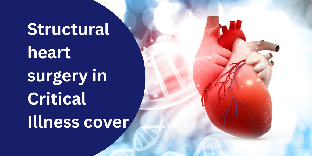 Structural heart surgery in Critical Illness cover