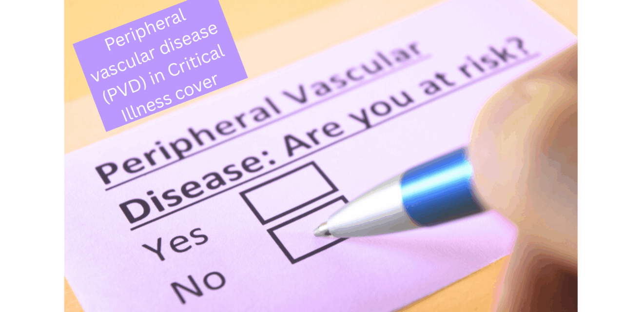 Peripheral vascular disease (PVD) in Critical Illness cover