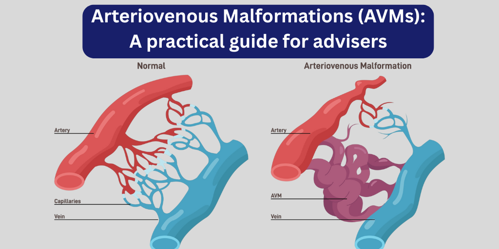 Arteriovenous Malformations (AVMs): A practical guide for advisers