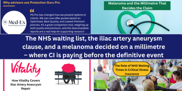The NHS waiting list, the iliac artery aneurysm clause, and a melanoma decided on a millimetre – where CI is paying before the definitive event
